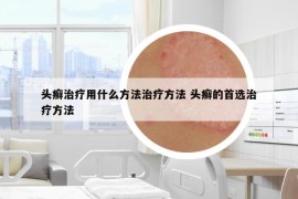 头癣治疗用什么方法治疗方法 头癣的首选治疗方法