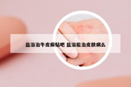 盐浴治牛皮癣贴吧 盐浴能治皮肤病么