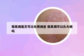 银屑病是否可以办理病退 银屑病可以办大病吗