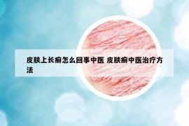 皮肤上长癣怎么回事中医 皮肤癣中医治疗方法