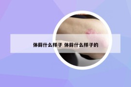 体藓什么样子 体藓什么样子的