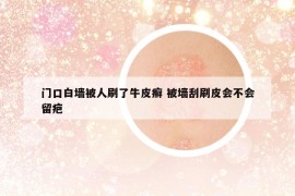 门口白墙被人刷了牛皮癣 被墙刮刷皮会不会留疤