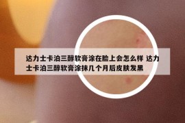 达力士卡泊三醇软膏涂在脸上会怎么样 达力士卡泊三醇软膏涂抹几个月后皮肤发黑