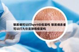 银屑病可以打hpv9价疫苗吗 银屑病患者可以打九价宫颈癌疫苗吗