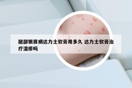 腿部银屑病达力士软膏用多久 达力士软膏治疗湿疹吗