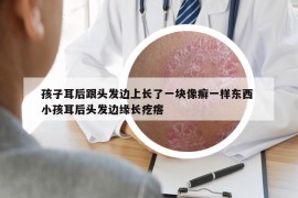 孩子耳后跟头发边上长了一块像癣一样东西 小孩耳后头发边缘长疙瘩