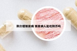 荆介穗银屑病 银屑病人能吃荆芥吗