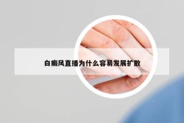 白癜风直播为什么容易发展扩散