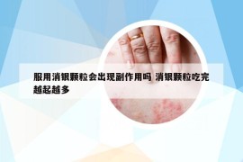 服用消银颗粒会出现副作用吗 消银颗粒吃完越起越多