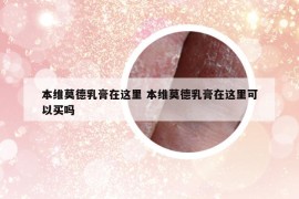 本维莫德乳膏在这里 本维莫德乳膏在这里可以买吗