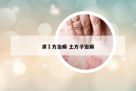 求傓方治癣 土方子治癣