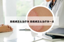 脓疱病怎么治疗快 脓疱病怎么治疗快一点