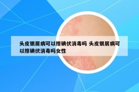 头皮银屑病可以擦碘伏消毒吗 头皮银屑病可以擦碘伏消毒吗女性