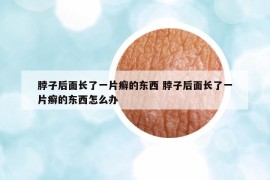 脖子后面长了一片癣的东西 脖子后面长了一片癣的东西怎么办