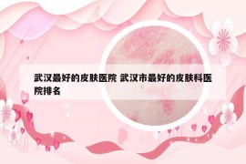 武汉最好的皮肤医院 武汉市最好的皮肤科医院排名
