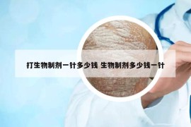 打生物制剂一针多少钱 生物制剂多少钱一针