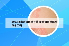 2023济南市银屑病补偿 济南银屑病医院改名了吗