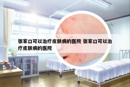 张家口可以治疗皮肤病的医院 张家口可以治疗皮肤病的医院