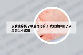 皮肤瘙痒抓了以后出现癣了 皮肤瘙痒抓了以后会出小疙瘩