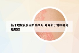 新丁地松乳膏治白癜风吗 外用新丁地松乳膏适应症