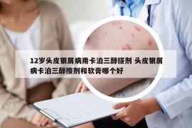 12岁头皮银屑病用卡泊三醇搽剂 头皮银屑病卡泊三醇擦剂和软膏哪个好