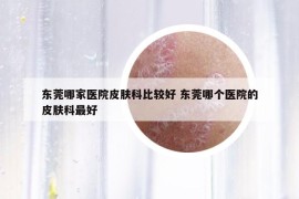 东莞哪家医院皮肤科比较好 东莞哪个医院的皮肤科最好