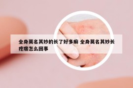 全身莫名其妙的长了好多癣 全身莫名其妙长疙瘩怎么回事