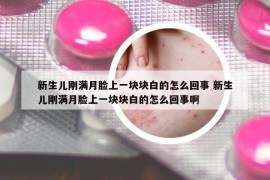 新生儿刚满月脸上一块块白的怎么回事 新生儿刚满月脸上一块块白的怎么回事啊