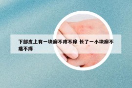 下部皮上有一块癣不疼不痒 长了一小块癣不痛不痒