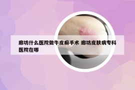 廊坊什么医院做牛皮癣手术 廊坊皮肤病专科医院在哪