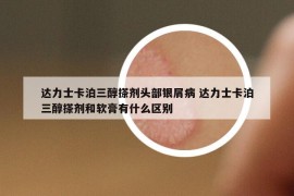 达力士卡泊三醇搽剂头部银屑病 达力士卡泊三醇搽剂和软膏有什么区别