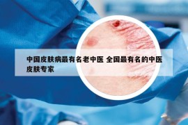 中国皮肤病最有名老中医 全国最有名的中医皮肤专家