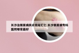 长沙治银屑病民众南站汇仁 长沙银屑病专科医院哪家最好