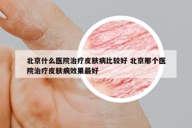 北京什么医院治疗皮肤病比较好 北京那个医院治疗皮肤病效果最好