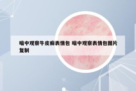 暗中观察牛皮癣表情包 暗中观察表情包图片复制