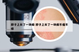 脖子上长了一块癣 脖子上长了一块癣不痛不痒