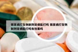 银屑病打生物制剂肾病能打吗 银屑病打生物制剂肾病能打吗有效果吗