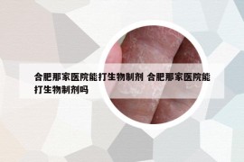 合肥那家医院能打生物制剂 合肥那家医院能打生物制剂吗