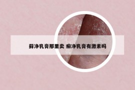 藓净乳膏那里卖 癣净乳膏有激素吗