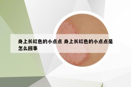 身上长红色的小点点 身上长红色的小点点是怎么回事