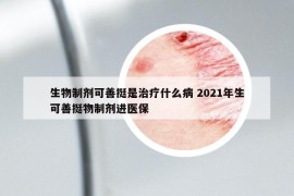 生物制剂可善挺是治疗什么病 2021年生可善挺物制剂进医保