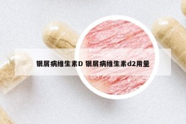 银屑病维生素D 银屑病维生素d2用量