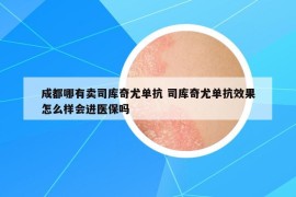 成都哪有卖司库奇尤单抗 司库奇尤单抗效果怎么样会进医保吗