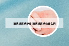 滴状银屑病静养 滴状银屑病吃什么药