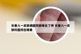 长春八一皮肤病医院搬哪去了啊 长春八一皮肤科医院在哪里