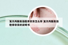 复方丙酸氯倍他索软膏怎么样 复方丙酸氯倍他索软膏的说明书