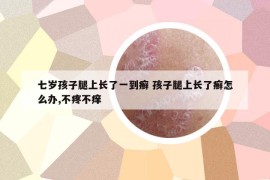 七岁孩子腿上长了一到癣 孩子腿上长了癣怎么办,不疼不痒