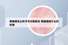 银翘病怎么样才可以稳固住 银翘病用什么药好使