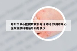 郑州市中心医院皮肤科电话号码 郑州市中心医院皮肤科电话号码是多少