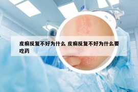 皮癣反复不好为什么 皮癣反复不好为什么要吃药